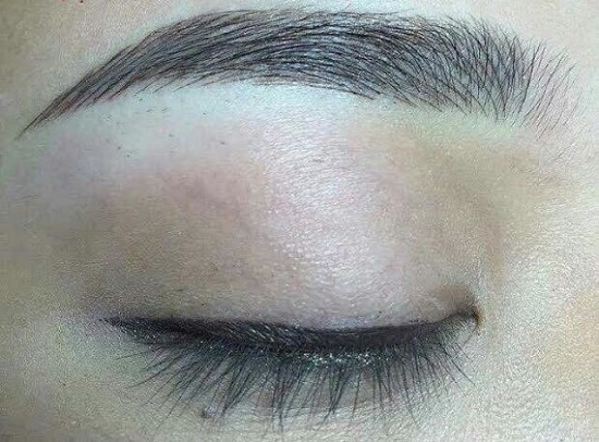 Kinh nghiệm chữa bầm tím vì điêu khắc chân mày